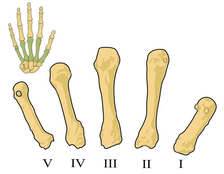 dieta osteoporoza