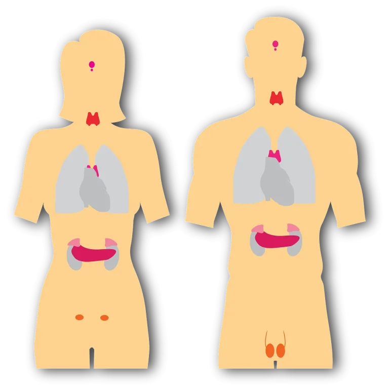 nodul hipoecogen tiroida